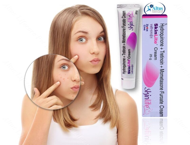 Skinlite Cream 17