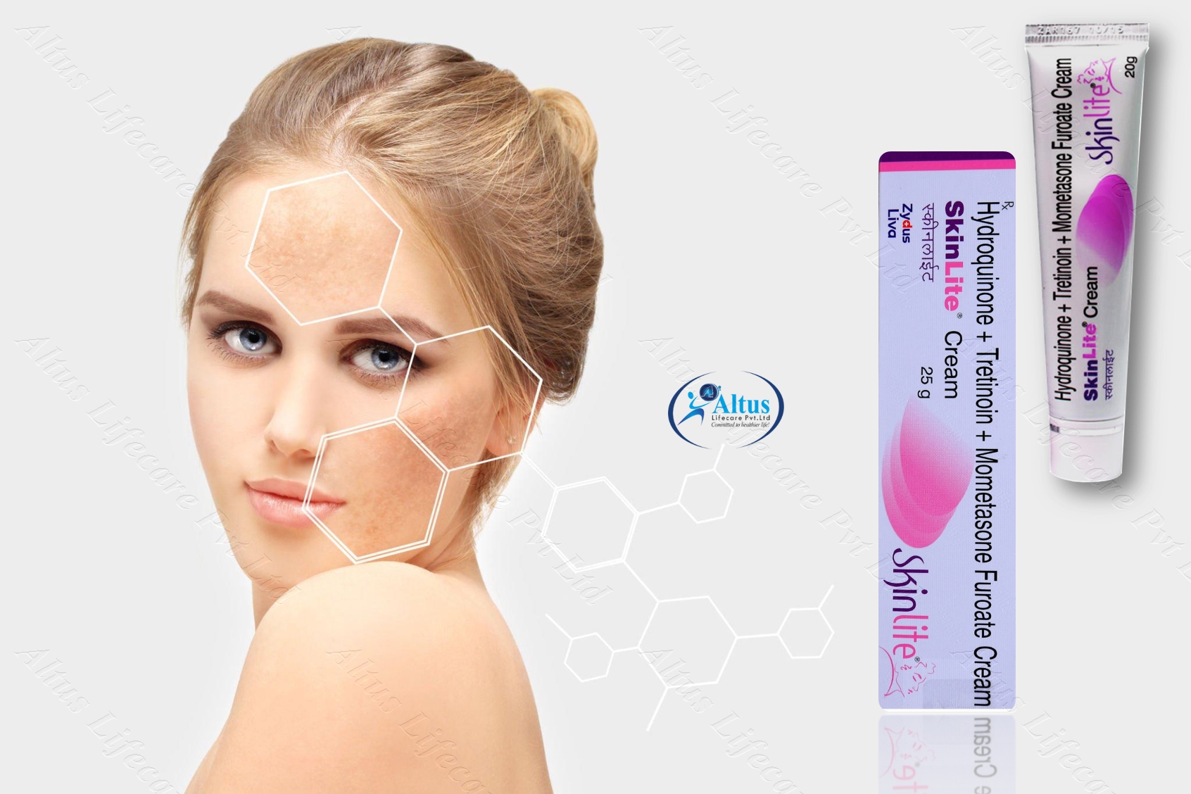 Hyperpigmentation of the Skin: Get Radiant Skin Fast!
